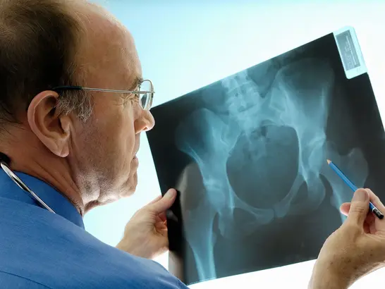 Ein Arzt untersucht eine Röntgenaufnahme des Beckens und hält dabei einen Bleistift in der Hand, um Einzelheiten hervorzuheben. Er trägt eine Brille, ein blaues Hemd und ein Stethoskop um den Hals. Die Röntgenaufnahme wird gegen eine Lichtquelle gehalten, um deutlich sichtbar zu sein.
